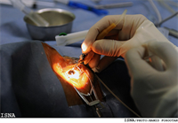 بازسازی شکستگی کاسه چشم با تکنولوژی پرینتر سه بعدی در اهواز